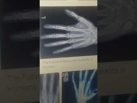 Revelation 13 :16-18. Revelation 14:9-11