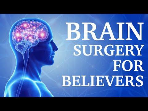 Reveal Fellowship:”Brain Surgery For Believers" - Romans 12:2   -   2/24/2016