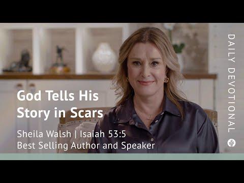 God Tells His Story in Scars | Isaiah 53:5 | Our Daily Bread Video Devotional