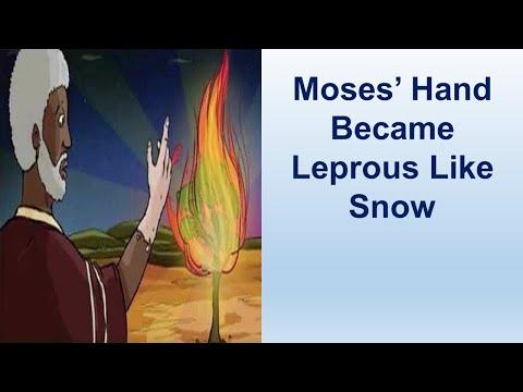 Moses' Hand Became Leprous Like Snow - Exodus 4:1-31