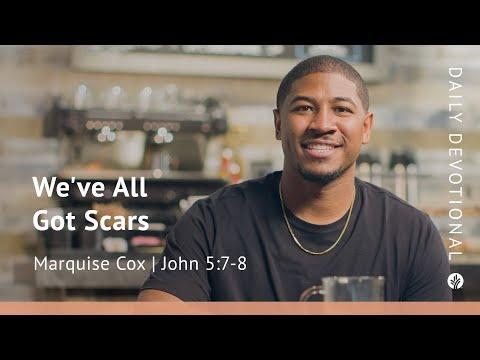We’ve All Got Scars | John 5:7–8 | Our Daily Bread Video Devotional