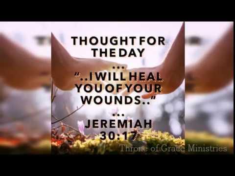 I will heal you( Jeremiah 30:17) Thought for the day, Aug 9, 2018