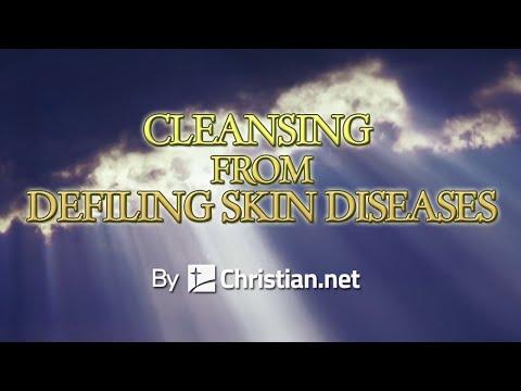 Leviticus 14:1 - 32: Cleansing From Defiling Skin Diseases | Bible Stories